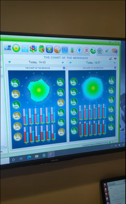 BrainTap HRV